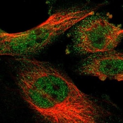 KLHL25 Antibody, Novus Biologicals:Antibodies:Primary Antibodies
